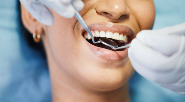 Best Knocked-Out Tooth Emergency  in Navarre, OH