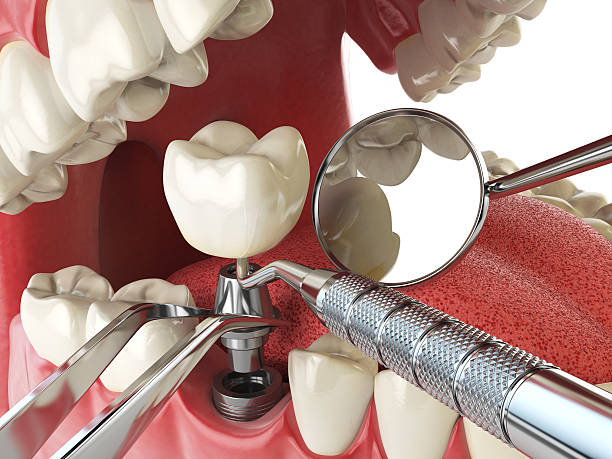 Best Urgent Tooth Repair  in Navarre, OH